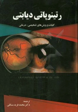 رتینوپاتی دیابتی: کلیات و روش‌های تشخیصی - درمانی