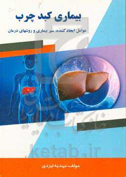 بیماری کبد چرب: عوامل ایجادکننده، سیر بیماری و روش‌های درمان