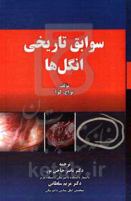 سوابق تاریخی انگل‌ها