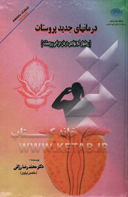 درمانهای جدید پروستات
