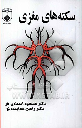 سکته‌های مغزی