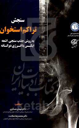 سنجش تراکم استخوان به روش جذب‌سنجی اشعه ایکس با انرژی دوگانه