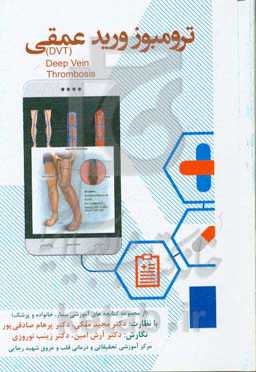 ترمبوز ورید عمقی