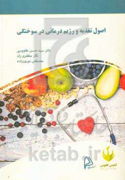 اصول تغذیه و رژیم‌درمانی در سوختگی