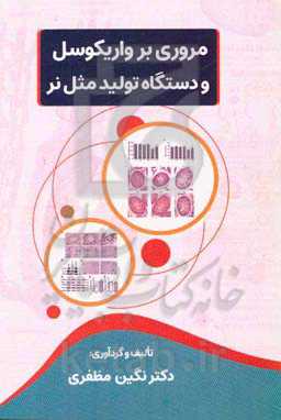 مروری بر واریکوسل و دستگاه تولید مثل نر