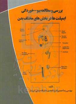 بررسی و مطالعه بیو - خوردگی ایمپلنت‌ها در بخش‌های مختلف بدن