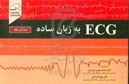 ECG به زبان ساده