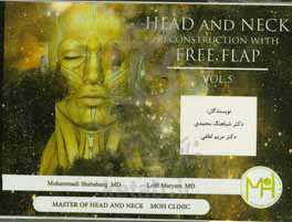 Head and neck reconstruction with free flap: case presentation