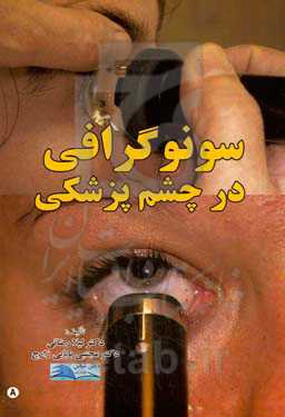 سونوگرافی در چشم‌پزشکی
