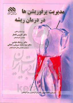 مدیریت انواع پرفوریشن‌ها در درمان‌های ریشه