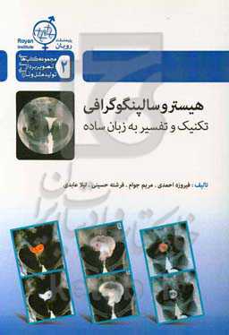 هیستروسالپنگوگرافی: تکنیک و تفسیر به زبان ساده