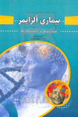 بیماری آلزایمر = Alzheimers's disease