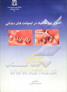 اصول بیومکانیک در ایمپلنت‌های دندانی