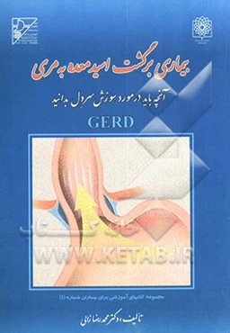 بیماری برگشت اسید معده به مری: آنچه باید در مورد سوزش سر دل بدانید Gerd