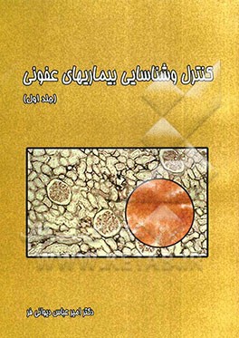 کنترل و شناسایی بیماریهای عفونی