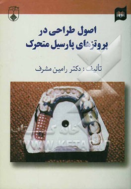 اصول طراحی در پروتزهای پارسیل متحرک