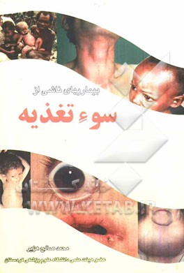 بیماری‌های ناشی از سوء تغذیه