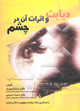 دیابت و اثرات آن در چشم