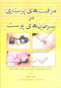 مراقبتهای پرستاری در سرطانهای پوست: قابل استفاده کلیه دانشجویان رشته‌های پزشکی و پیراپزشکی