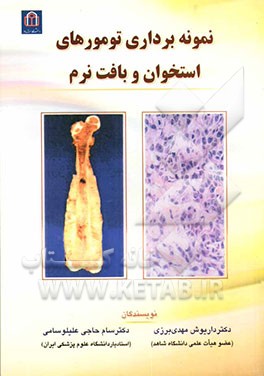 نمونه‌برداری تومورهای استخوان و بافت نرم