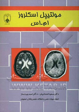 مولتیپل اسکلروز (ام. اس)