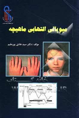 میوتاپی التهابی ماهیچه‌ای