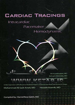 Cardiac tracings intracardiac pacemaker hemodynamic