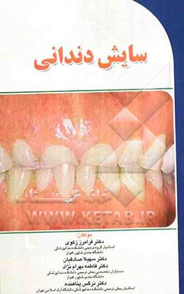 سایش دندانی