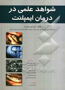 شواهد علمی در درمان ایمپلنت