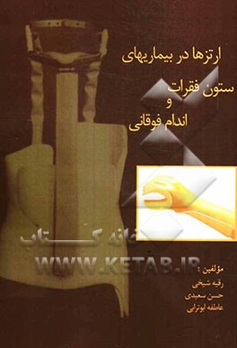 ارتزها در بیماری‌های ستون فقرات و اندام فوقانی