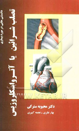 دانستنی‌هایی در مورد بیماری تصلب شرائین یا آترواسکلروزیس