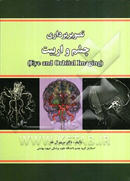 تصویربرداری چشم و اربیت (Eye and orbital imaging)