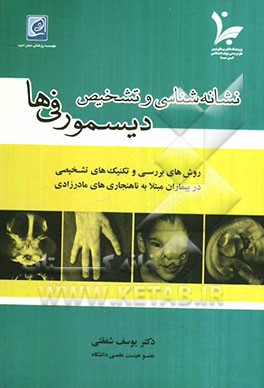 نشانه‌شناسی و تشخیص دیسمورفی‌ها: روشهای بررسی و تکنیک‌های تشخیصی در بیماران مبتلا به ناهنجاری‌های مادرزادی