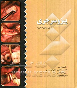 پیزو سرجری (اصول و کاربرد)