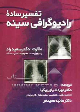 تفسیر ساده رادیوگرافی سینه (با روش آسان)