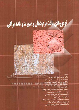 تومورهای بافت نرم دهان و صورت و غدد بزاقی