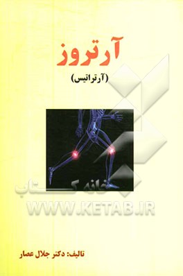 آرتروز (آرتراتیس)