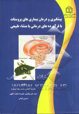 پیشگیری و درمان بیماری‌های پروستات با فرآورده‌های درمانی با منشاء طبیعی