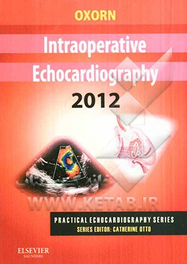 Intraoperative echocardiography