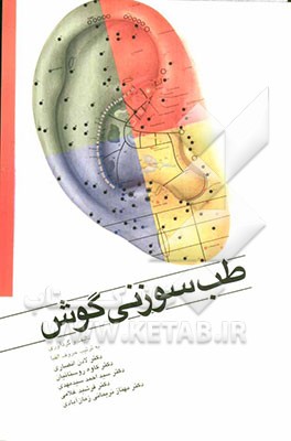 طب سوزنی گوش