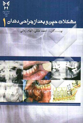 مشکلات حین و بعد از جراحی دندان
