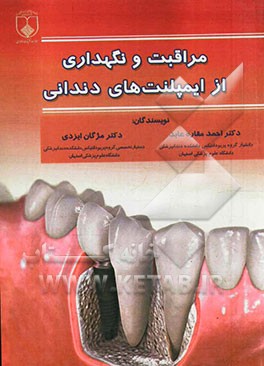 مراقبت و نگهداری از ایمپلنت‌های دندانی