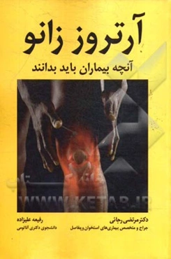 آرتروز زانو: آنچه بیماران باید بدانند