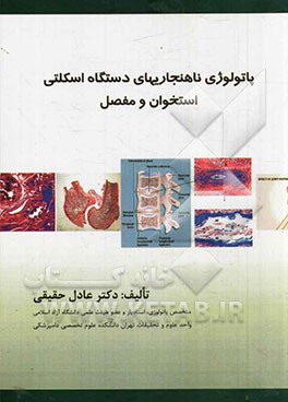 پاتولوژی ناهنجاری‌های دستگاه اسکلتی استخوان و مفاصل