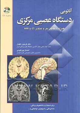 آناتومی دستگاه عصبی مرکزی همراه با تصاویر و مقاطع CT Scan و MRI