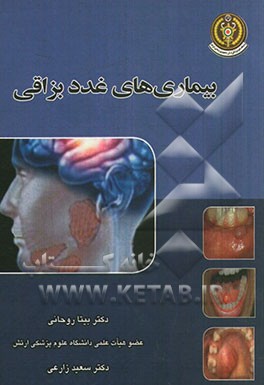 بیماری‌های غدد بزاقی