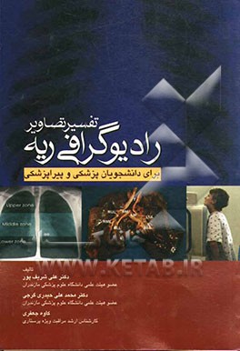 تفسیر تصاویر رادیوگرافی ریه برای دانشجویان پزشکی و پیراپزشکی