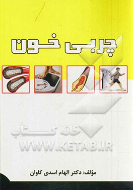 چربی خون (مرض قند)