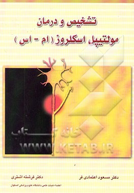 تشخیص و درمان مولتیپل اسکروز (ام‌اس)