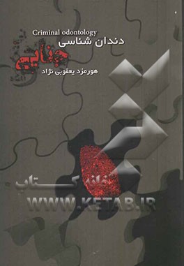 دندان‌شناسی جنایی (نقش دندان در کشف علمی جرائم)